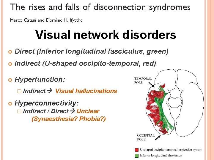 Visual network disorders Direct (Inferior longitudinal fasciculus, green) Indirect (U-shaped occipito-temporal, red) Hyperfunction: �