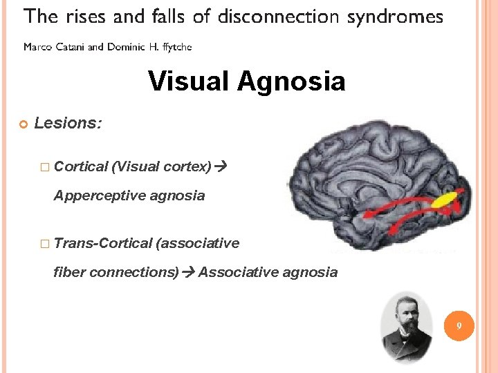 Visual Agnosia Lesions: � Cortical (Visual cortex) Apperceptive agnosia � Trans-Cortical (associative fiber connections)