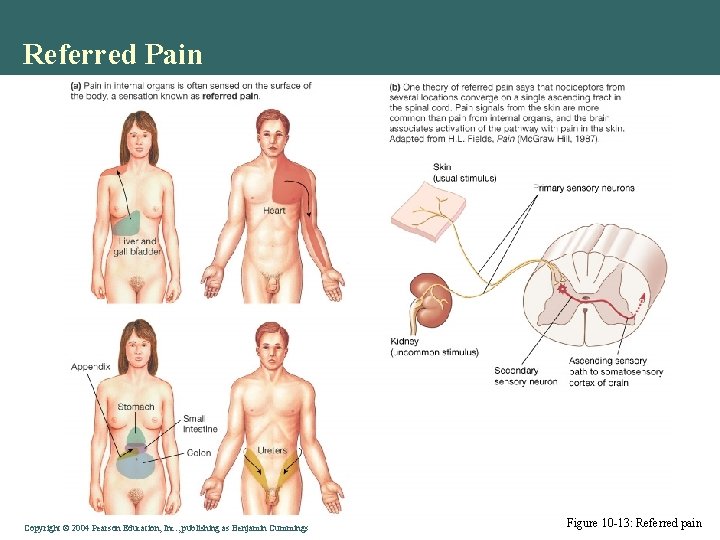 Referred Pain Copyright © 2004 Pearson Education, Inc. , publishing as Benjamin Cummings Figure