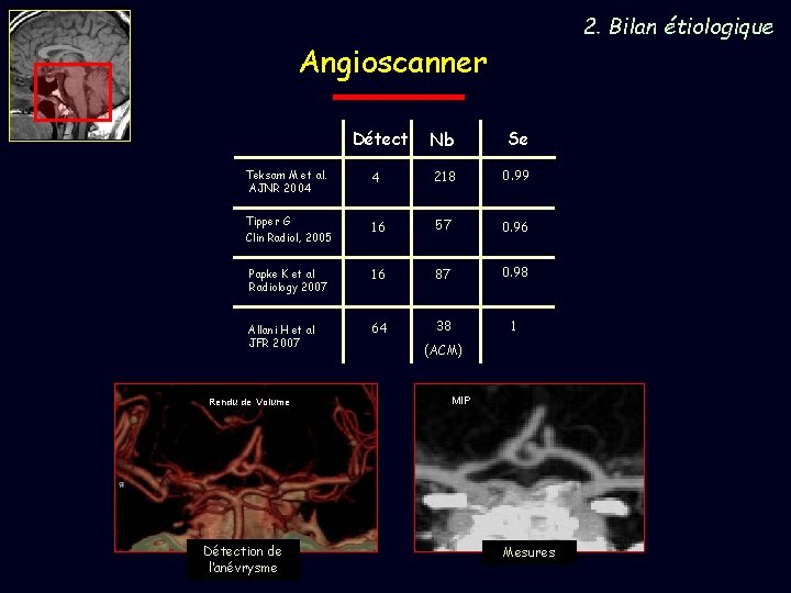 2. Bilan étiologique Angioscanner Détect Nb Se Teksam M et al. AJNR 2004 4