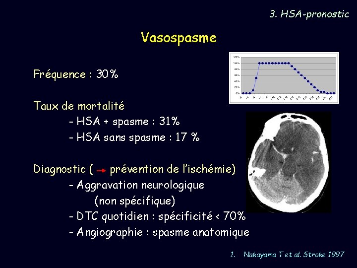 3. HSA-pronostic Vasospasme Fréquence : 30% Taux de mortalité - HSA + spasme :