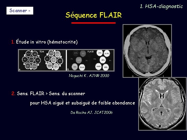 Scanner - Séquence FLAIR 1. Étude in vitro (hématocrite) TDM FLAIR Noguchi K. AJNR