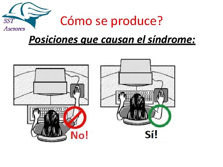 Cómo se produce? Posiciones que causan el síndrome: 