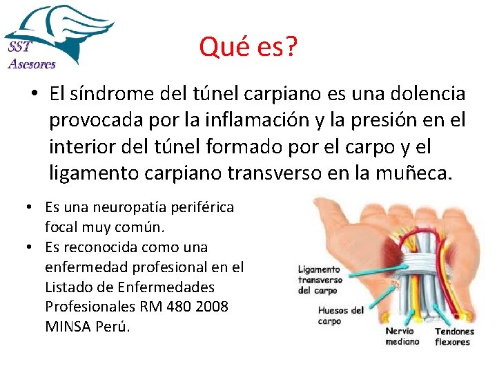 Qué es? • El síndrome del túnel carpiano es una dolencia provocada por la