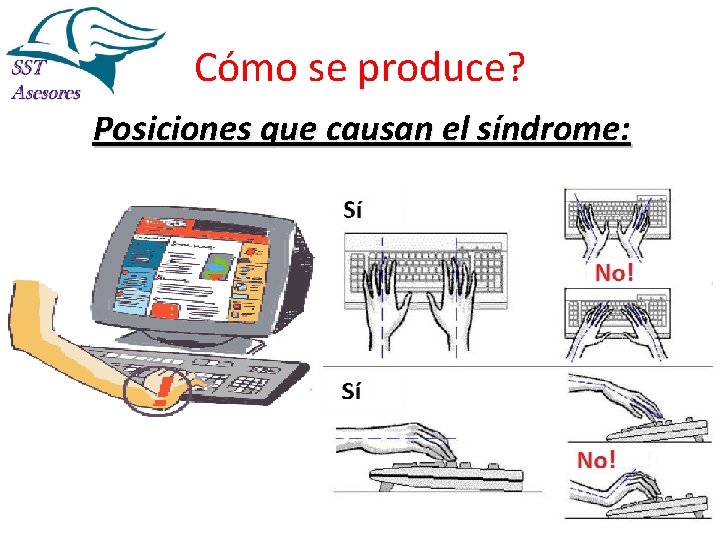 Cómo se produce? Posiciones que causan el síndrome: 