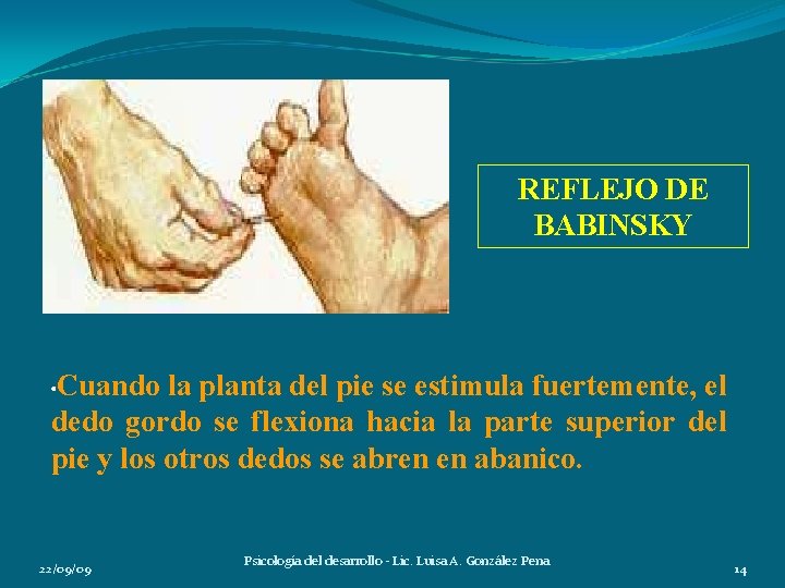 REFLEJO DE BABINSKY • Cuando la planta del pie se estimula fuertemente, el dedo REFLEJO DE BABINSKY • Cuando la planta del pie se estimula fuertemente, el dedo