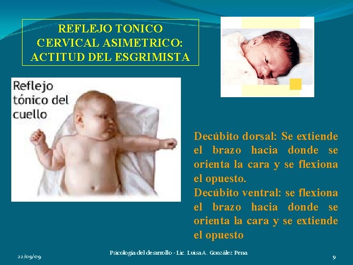 REFLEJO TONICO CERVICAL ASIMETRICO: ACTITUD DEL ESGRIMISTA Decúbito dorsal: Se extiende el brazo hacia REFLEJO TONICO CERVICAL ASIMETRICO: ACTITUD DEL ESGRIMISTA Decúbito dorsal: Se extiende el brazo hacia