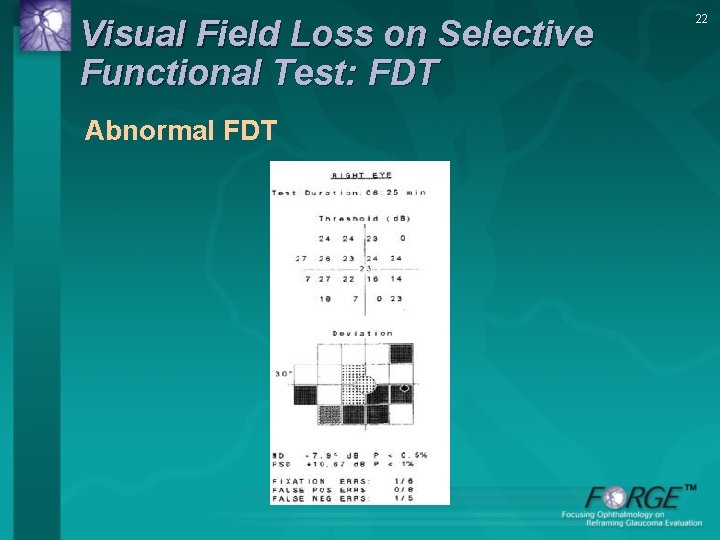 Visual Field Loss on Selective Functional Test: FDT Abnormal FDT 22 