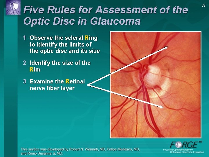Five Rules for Assessment of the Optic Disc in Glaucoma 1 Observe the scleral