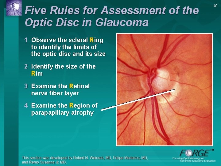 Five Rules for Assessment of the Optic Disc in Glaucoma 1 Observe the scleral