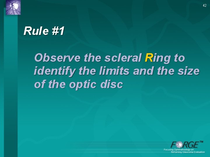 42 Rule #1 Observe the scleral Ring to identify the limits and the size
