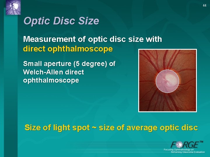 44 Optic Disc Size Measurement of optic disc size with direct ophthalmoscope Small aperture