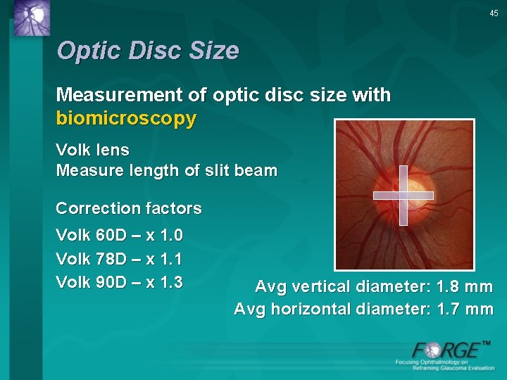 45 Optic Disc Size Measurement of optic disc size with biomicroscopy Volk lens Measure