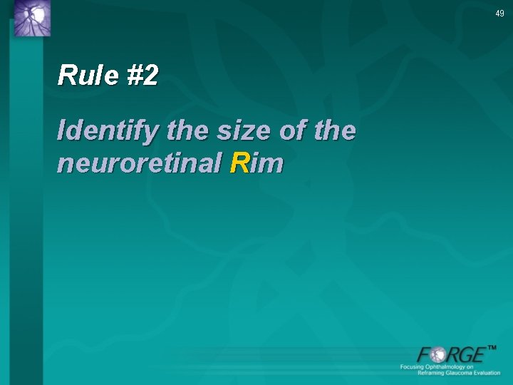 49 Rule #2 Identify the size of the neuroretinal Rim 