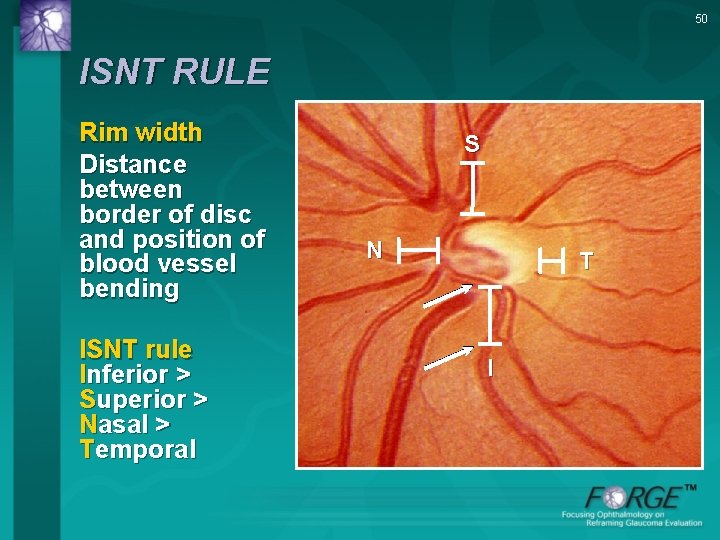 50 ISNT RULE Rim width Distance between border of disc and position of blood