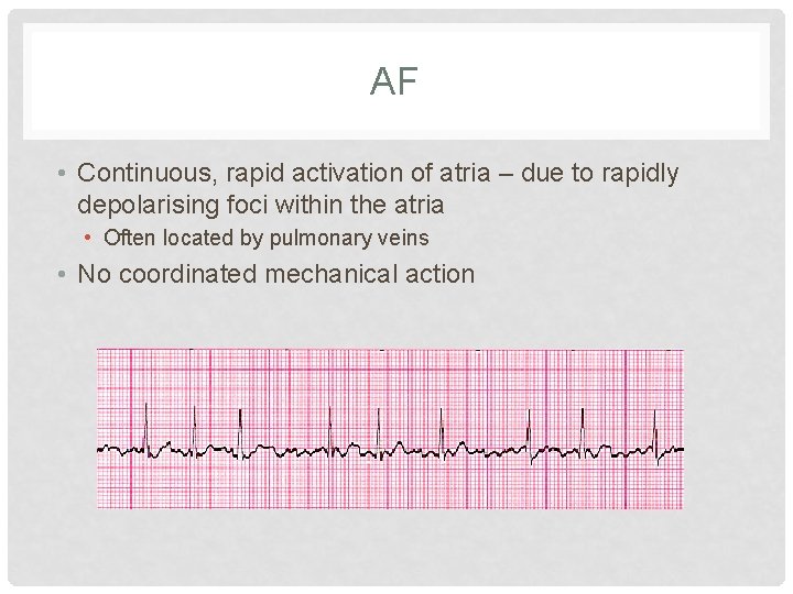 AF • Continuous, rapid activation of atria – due to rapidly depolarising foci within