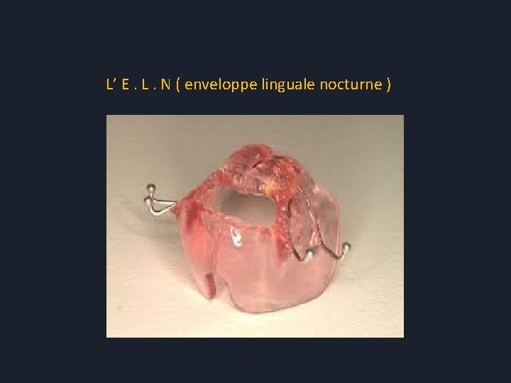 L’ E. L. N ( enveloppe linguale nocturne ) 