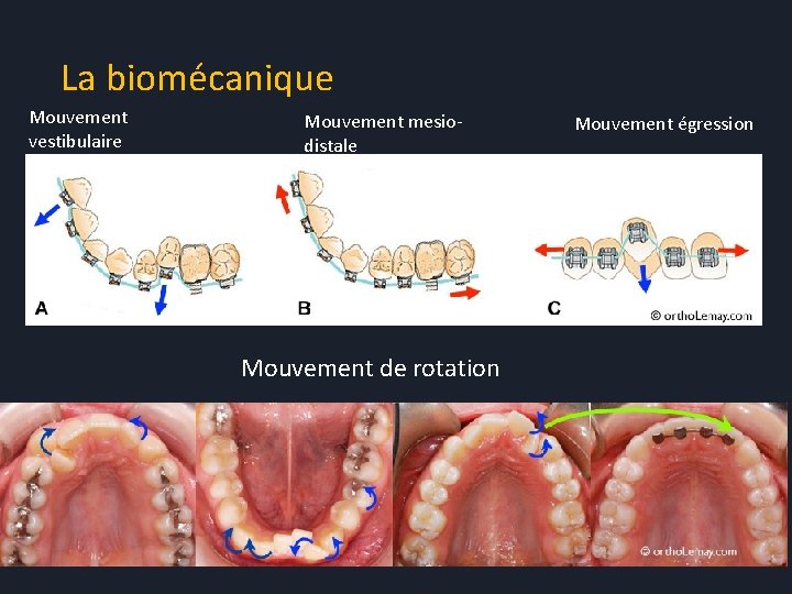 La biomécanique Mouvement vestibulaire Mouvement mesiodistale Mouvement de rotation Mouvement égression 
