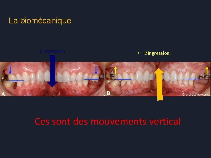 La biomécanique L’ égression ▪ L’Ingression Ces sont des mouvements vertical 