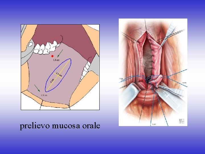 prelievo mucosa orale 