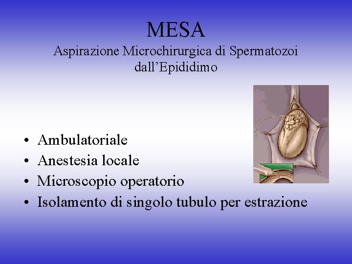 MESA Aspirazione Microchirurgica di Spermatozoi dall’Epididimo • • Ambulatoriale Anestesia locale Microscopio operatorio Isolamento