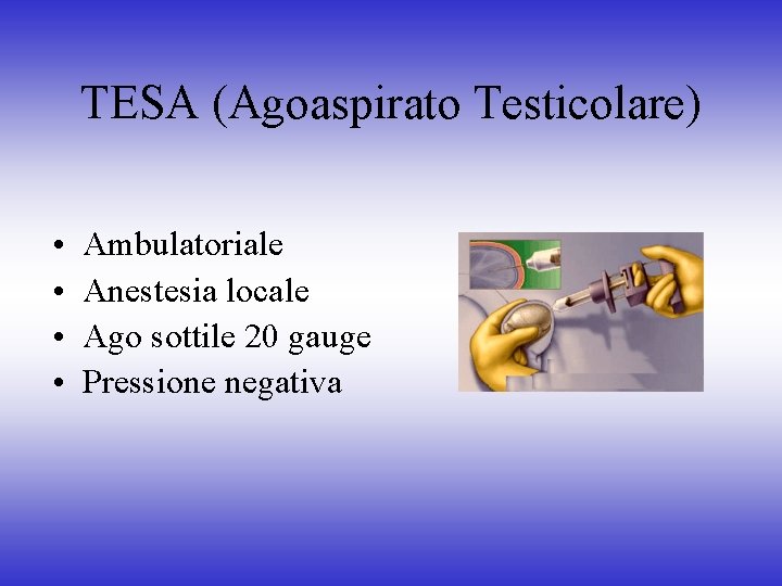 TESA (Agoaspirato Testicolare) • • Ambulatoriale Anestesia locale Ago sottile 20 gauge Pressione negativa