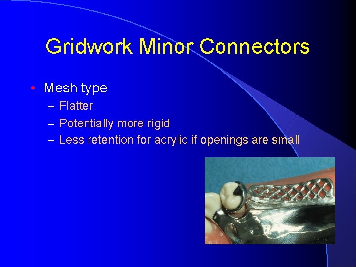 Gridwork Minor Connectors • Mesh type – Flatter – Potentially more rigid – Less