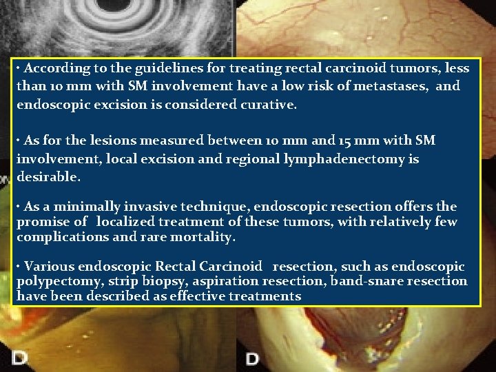  • According to the guidelines for treating rectal carcinoid tumors, less than 10