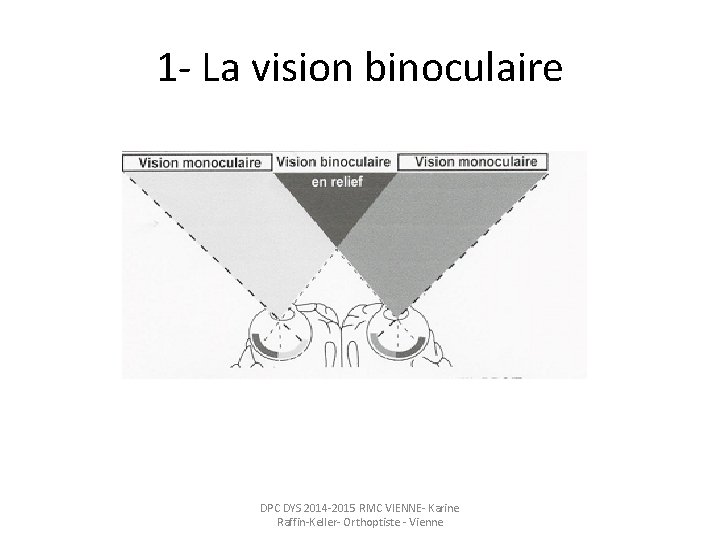 1 - La vision binoculaire DPC DYS 2014 -2015 RMC VIENNE- Karine Raffin-Keller- Orthoptiste