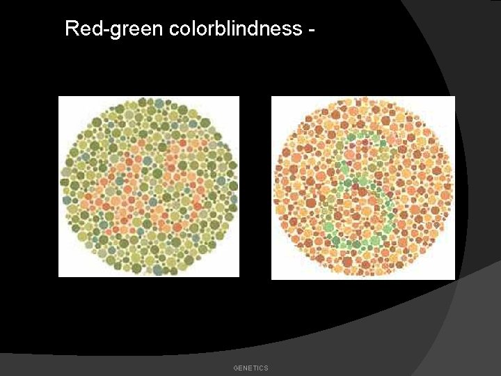 Red-green colorblindness - GENETICS 