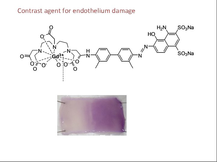 Contrast agent for endothelium damage 