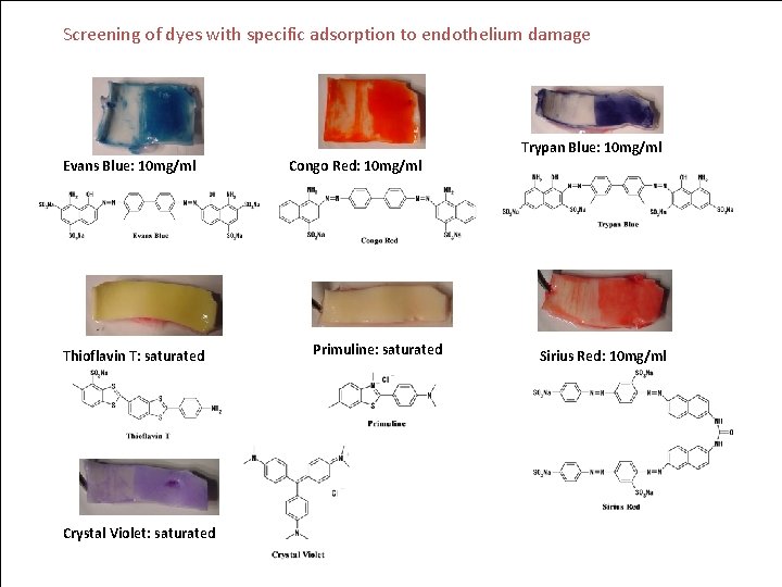 Screening of dyes with specific adsorption to endothelium damage Evans Blue: 10 mg/ml Thioflavin
