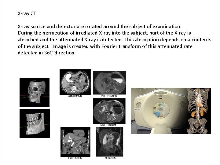 X-ray CT X-ray source and detector are rotated around the subject of examination. During