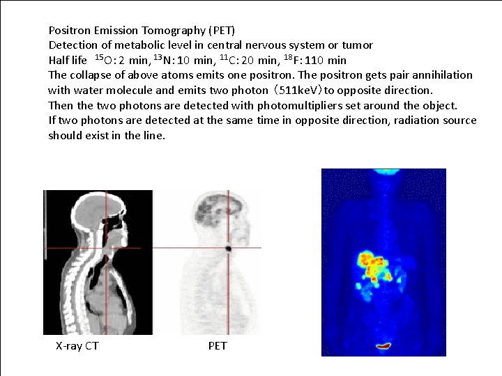 Positron Emission Tomography (PET) Detection of metabolic level in central nervous system or tumor