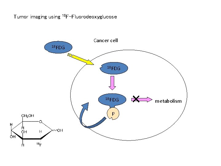 Tumor imaging using 18 F-Fluorodeoxyglucose Cancer cell 18 FDG P × metabolism 