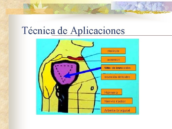 Técnica de Aplicaciones 