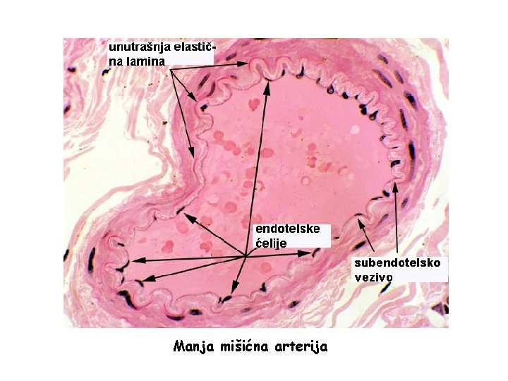 Manja mišićna arterija Manja mišićna arterija
