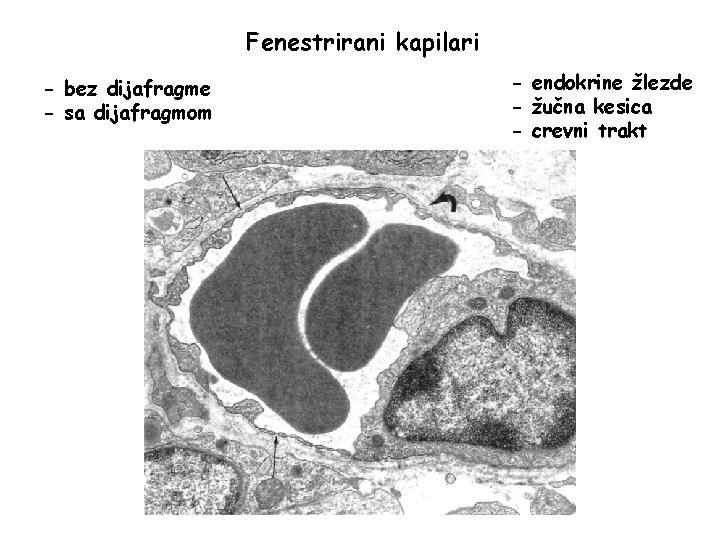Fenestrirani kapilari - bez dijafragme - sa dijafragmom - endokrine žlezde - žučna kesica Fenestrirani kapilari - bez dijafragme - sa dijafragmom - endokrine žlezde - žučna kesica