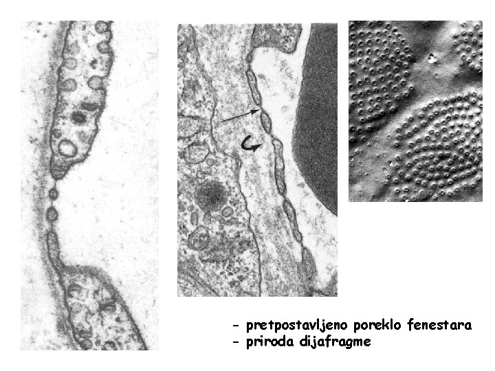 - pretpostavljeno poreklo fenestara - priroda dijafragme 