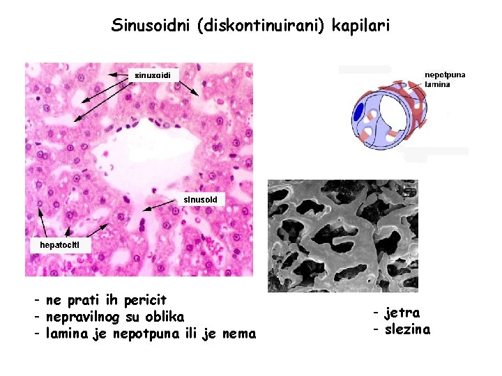 Sinusoidni (diskontinuirani) kapilari - ne prati ih pericit - nepravilnog su oblika - lamina
