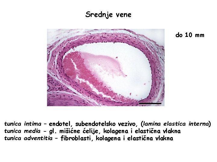 Srednje vene do 10 mm tunica intima – endotel, subendotelsko vezivo, (lamina elastica interna) Srednje vene do 10 mm tunica intima – endotel, subendotelsko vezivo, (lamina elastica interna)