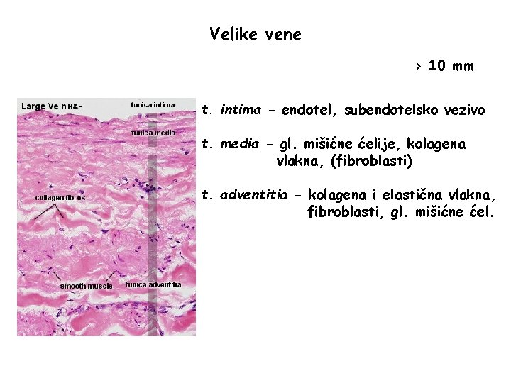 Velike vene > 10 mm t. intima - endotel, subendotelsko vezivo t. media -