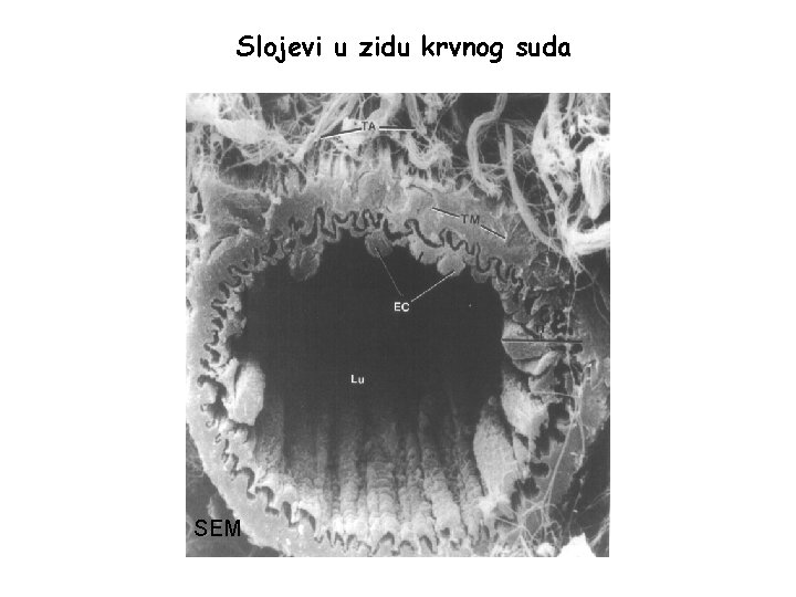 Slojevi u zidu krvnog suda SEM Slojevi u zidu krvnog suda SEM