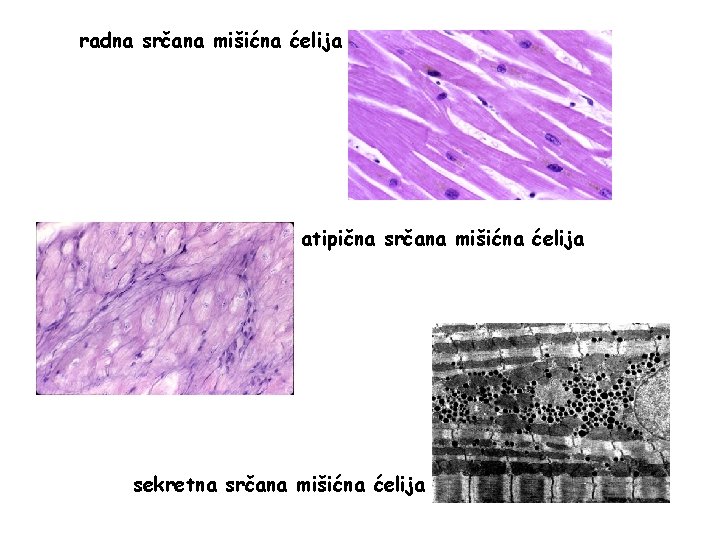 radna srčana mišićna ćelija atipična srčana mišićna ćelija sekretna srčana mišićna ćelija 