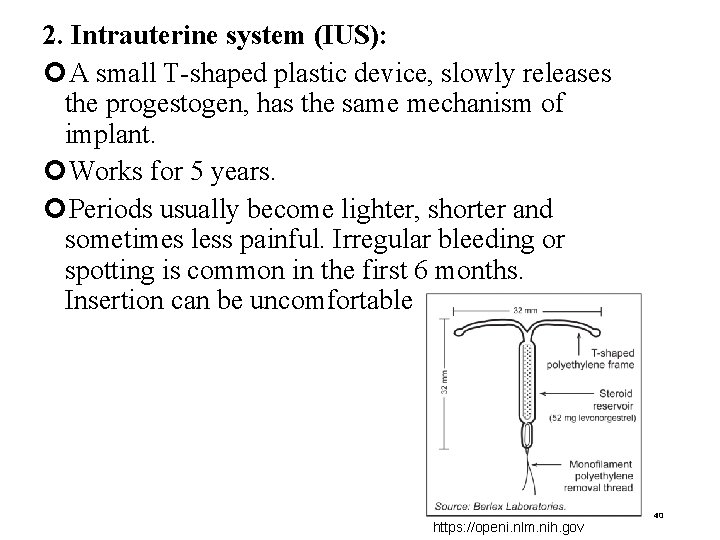 2. Intrauterine system (IUS): A small T-shaped plastic device, slowly releases the progestogen, has