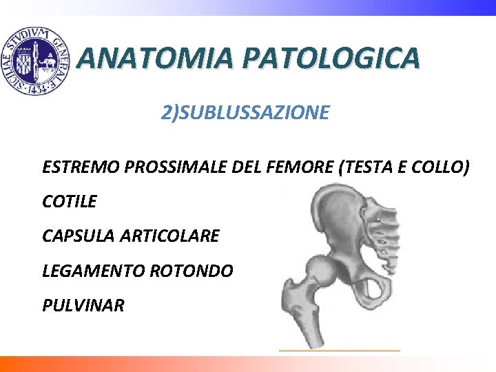 ANATOMIA PATOLOGICA 2)SUBLUSSAZIONE ESTREMO PROSSIMALE DEL FEMORE (TESTA E COLLO) COTILE CAPSULA ARTICOLARE LEGAMENTO