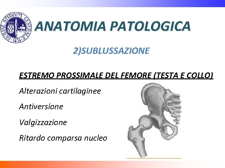 ANATOMIA PATOLOGICA 2)SUBLUSSAZIONE ESTREMO PROSSIMALE DEL FEMORE (TESTA E COLLO) Alterazioni cartilaginee Antiversione Valgizzazione