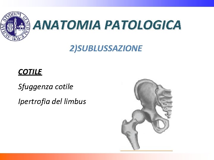 ANATOMIA PATOLOGICA 2)SUBLUSSAZIONE COTILE Sfuggenza cotile Ipertrofia del limbus 