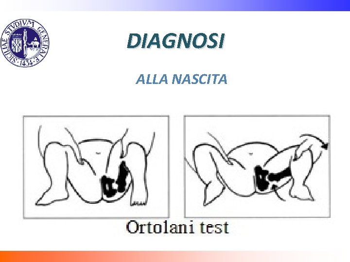 DIAGNOSI ALLA NASCITA 