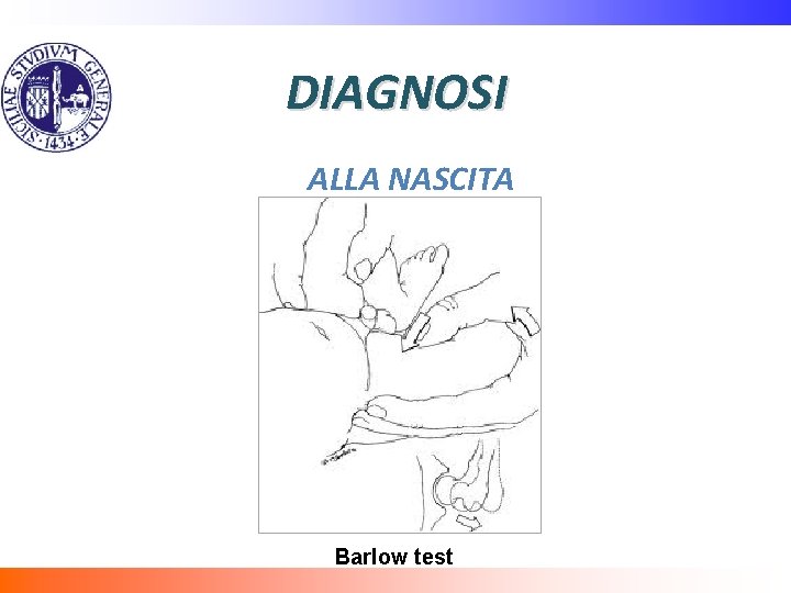 DIAGNOSI ALLA NASCITA Barlow test 